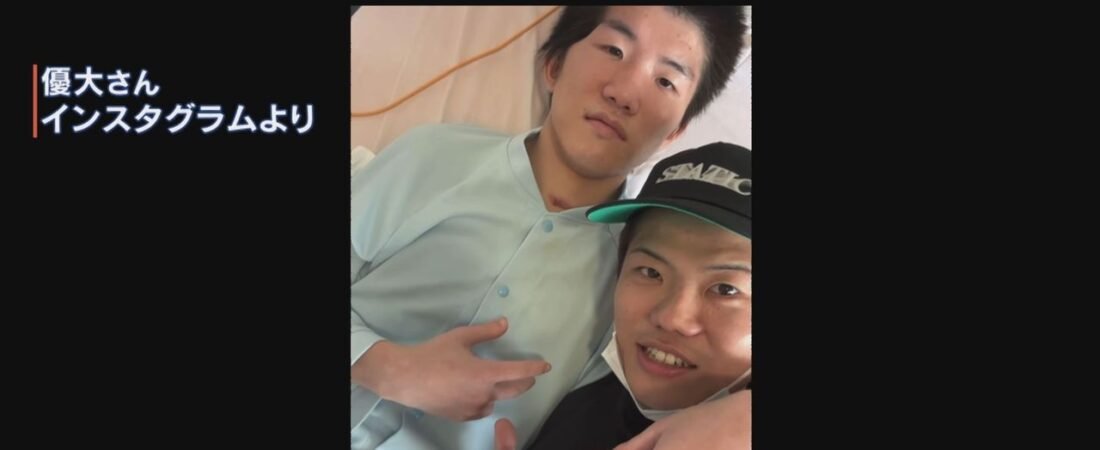 重岡銀次朗さんに後遺症 兄の決意
