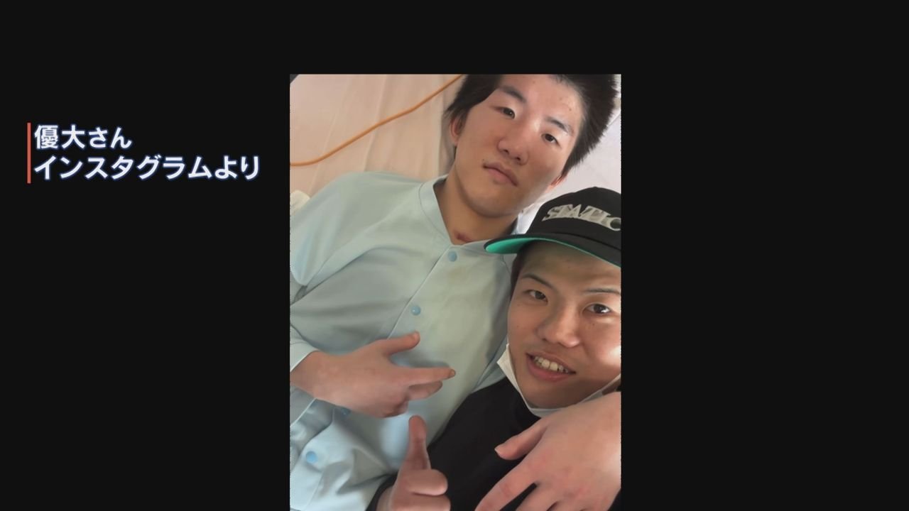重岡銀次朗さんに後遺症 兄の決意