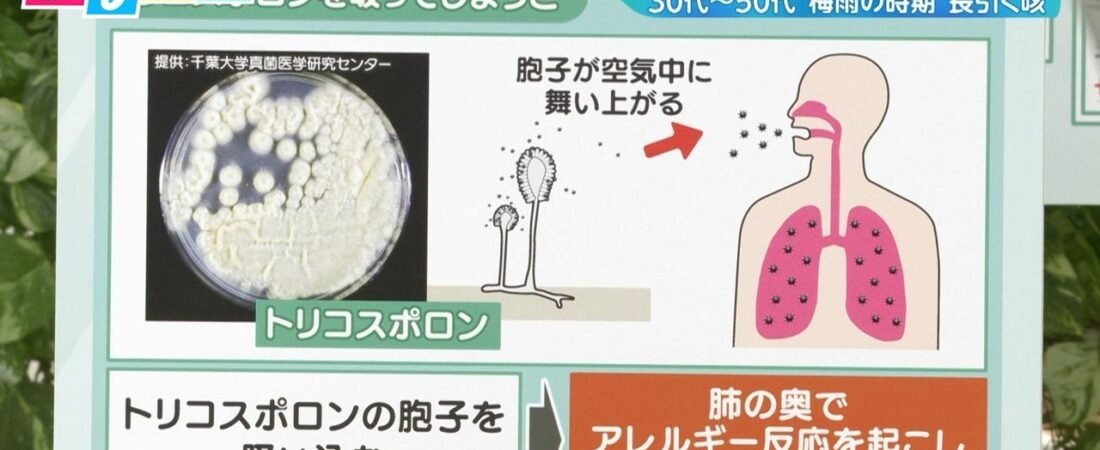 長引く咳 白いカビ原因の肺炎注意