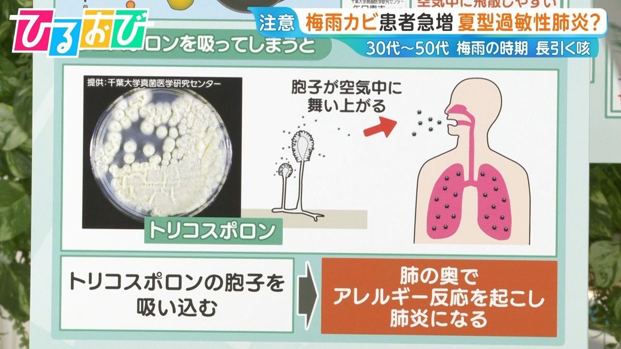 長引く咳 白いカビ原因の肺炎注意