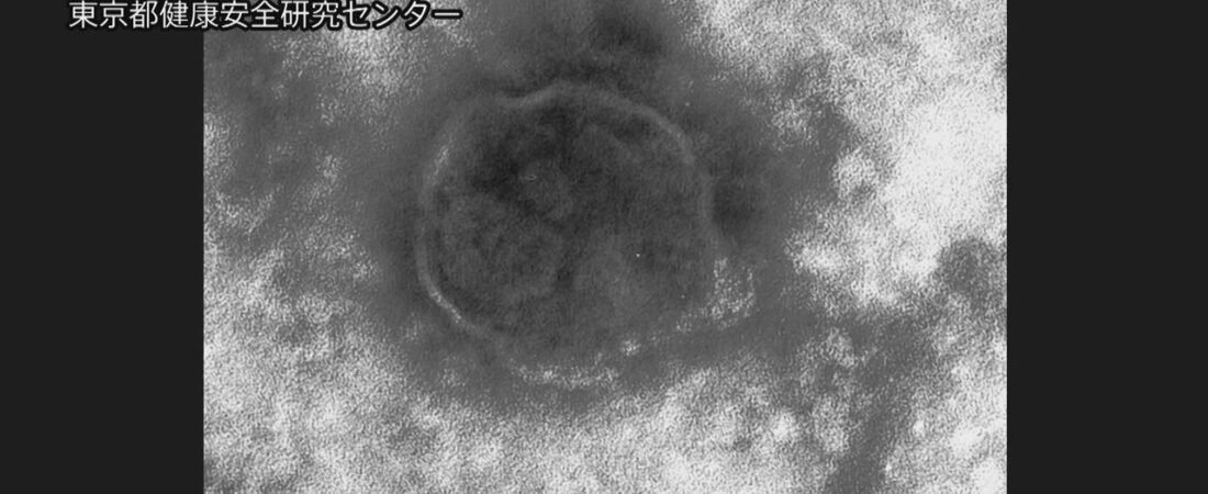 はしか感染者数 昨年の約3.9倍